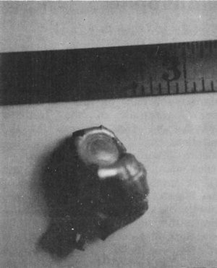 Contemporary black-and-white photograph of the deformed 7mm bullet that Carl Higdon said he fired at a bull elk and that traveled only fifty to sixty feet before going "splat" and dropping into the snow. The jacket appears mushroomed and turned in on itself beside a ruler at the three-inch mark. This is a photograph of the real recovered artifact, not a reconstruction. The bullet was later examined by APRO metallurgist Dr. Walter Walker and a University of Wyoming metallurgist and then disappeared from a university safe.