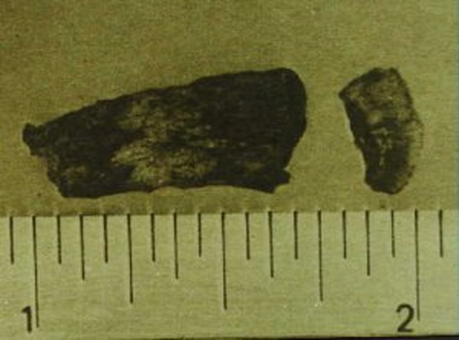 Two of the magnesium fragments said to have fallen on the beach at Ubatuba in 1957, photographed against a ruler for scale. These are the actual samples later tested by laboratories in Brazil and the United States.